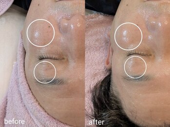 シャリル(charire)/目元のシワ改善