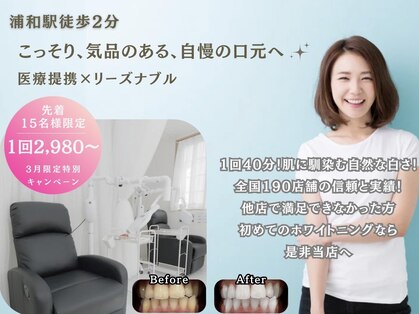 ホワイトニングショップ 浦和店の写真