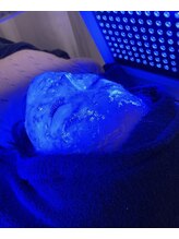 キスミー(Ksmiii)/LED光フェイシャル (ブルー)