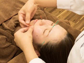 ラディアント 吉祥寺/土台から整える美容鍼