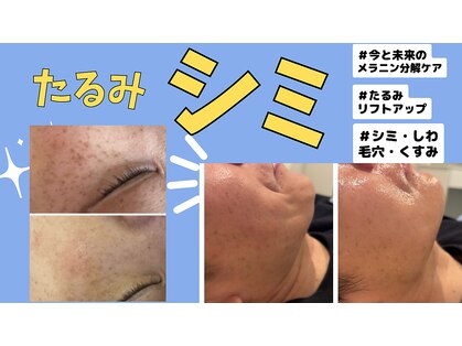 ミライ(Mirai)の写真