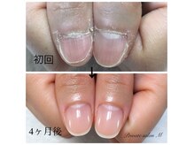 プライベートサロンエム(M)の雰囲気（【人気No. 1メニュー】自爪育成クリアジェルコース　）