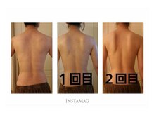 ル ミュー(le mieux)/REVI陶肌トリートメント