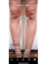 オフ(off)/足脱毛