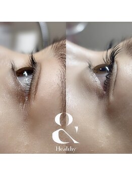 プライベートサロン ヴェール(Veil)/横から見ても綺麗!