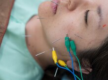 名古屋鍼灸 美容健康院/美容鍼