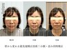 【口コミ・画像OKの方特別価格】最先端美小顔/背骨・骨盤の歪み美姿勢矯正3回