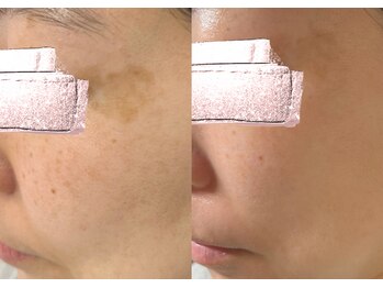 モガナ(mogana)/40代・選べるプランで理想の姿に