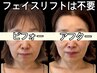 【人気No1贅沢8工程】美輪郭フル設計◆サーマクール＆ヒアル注入＆脂肪分解剤