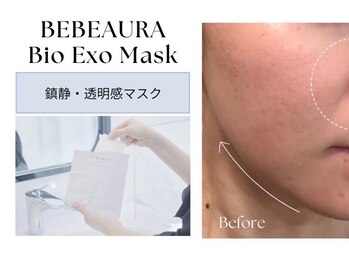 ビボーラ(BEBEAURA)/バイオエクソマスク