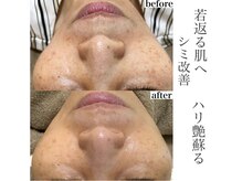 モンクラッシー(Mon classy)の雰囲気（シミを改善してハリ艶のあるマイナス10歳肌へ）