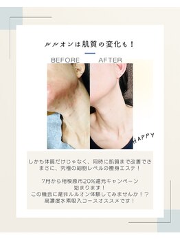 ヨサパーク ハロ(YOSA PARK Haro)/