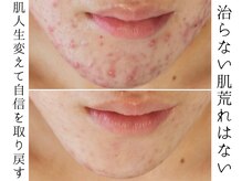 ユウビジン(YOU美人)/