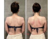 ビノワ(Binowa)/肩甲骨が正しい位置に★