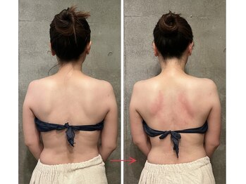 ビノワ(Binowa)/肩甲骨が正しい位置に★