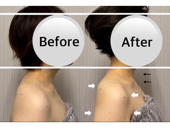 ベール(BEHL)/コルギBeforeAfter