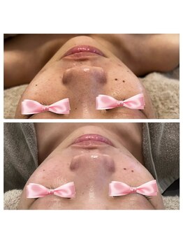 美温(mion)/レッドショット×インディバ