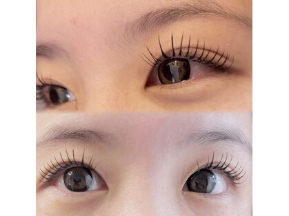 エント(Ento)の写真