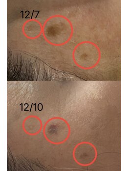 アンド リュクス(& Luxe)/プラペンでツンツンと。。。