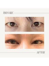 マーブル(marble)/お客様写真