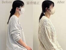 ひじ鍼灸整骨院の雰囲気(【Before /After】姿勢矯正/美容矯正◎)