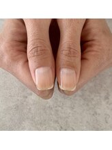 イル(iLL)/自爪育成～3ヶ月後～