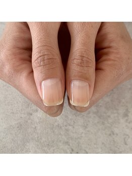 イル(iLL)/自爪育成～3ヶ月後～