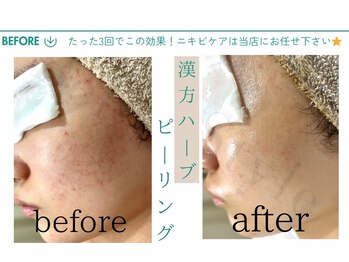 ベルスタイル(Bell style)/当店のお客様症例(ハーブ)