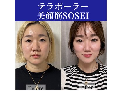 癒える(ielu)の写真