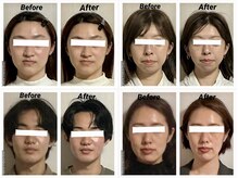 メディカルエステティックサロン リラックスイン(Relaxinn)