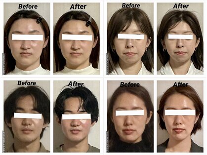 メディカルエステティックサロン リラックスイン(Relaxinn)の写真