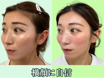 ナチュラルパーフェクトフェイス 新宿/小顔矯正/骨盤矯正/美脚矯正専門