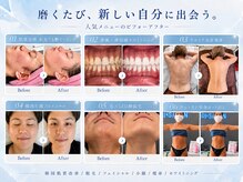 アイディー(Id)