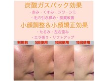 太陽と月の雰囲気(肌質改善×毛穴レス×小顔調整×全身リンパケア。深い癒しと美♪)