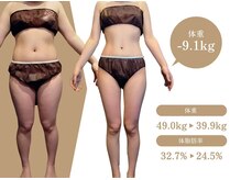 ビルーチェ(BELUCE)の雰囲気（【脂肪の落ち方が違う】最新３６０°C脂肪冷却導入店）