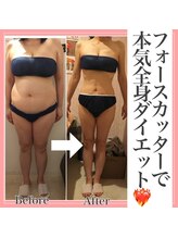 アンリール 旭川店(Anrire)/BODY施術のお客様です！