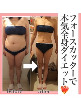 アンリール 旭川店(Anrire)/BODY施術のお客様です!