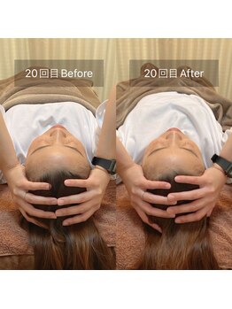 スリージー/before/after