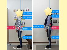 ナオル整体 大宮院(NAORU整体)/大宮/整体・猫背矯正・姿勢矯正