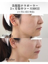 アオダモ(aodamo)/