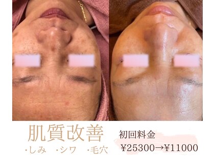 ソワイユ 浜松店(Soyeux)の写真