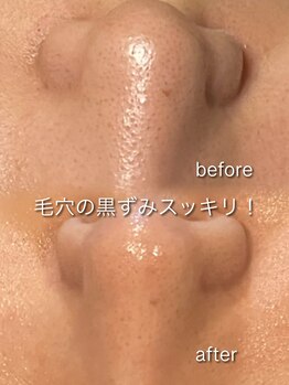 リイル バイ クレビア(REILE by Crebia)/お客様写真