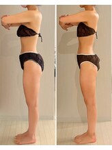 ヒールプラス(heal+)/二の腕スッキリ