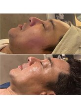 コアラル 恵比寿(COALALU)/クリスティーナアンストレス美肌