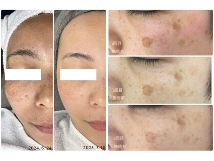 クリニカルホワイトケア 豊見城店(クリニカルWHITEケア)の写真