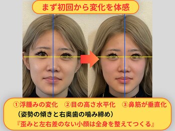 メディピークス/初回の変化確認