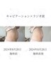 【2回目以降】【身体メンテ】ラジオ波(RF)+キャビテーション30分