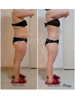 フェアリー(Fairy)/【痩身】ウルトランスフォーマー