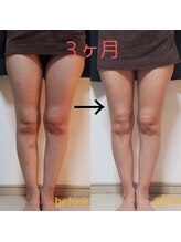 暖 手(ダンテ)/ＷＩＮＢＡＣＫ脚