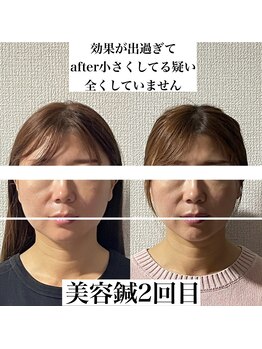 ヒールジョイ(HEAL JOY)/写真加工を疑われるレベル